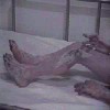 Alien Autopsy Photo 2